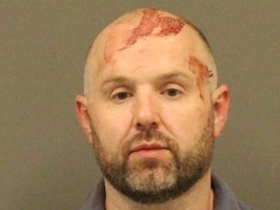 Plymouth man faces charges, civil suit after allegedly biting off part of his friend’s ear